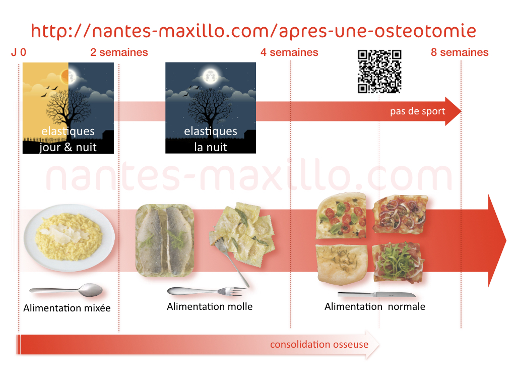 alimentation.001 Nantes Maxillo